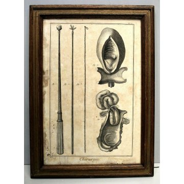 ANTICA STAMPA MEDICINA TAV 66 Chirurgie Pl. V ENCICLOPADIA STRUMENTI CHIRURGICI