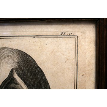 ANTICA STAMPA MEDICINA TAV 66 Chirurgie Pl. V ENCICLOPADIA STRUMENTI CHIRURGICI