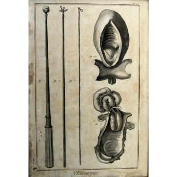ANTICA STAMPA MEDICINA TAV 66 Chirurgie Pl. V ENCICLOPADIA STRUMENTI CHIRURGICI